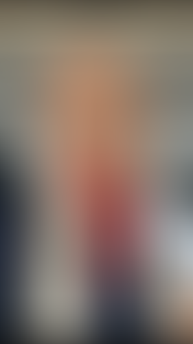 Geblurrte Content-Vorschau