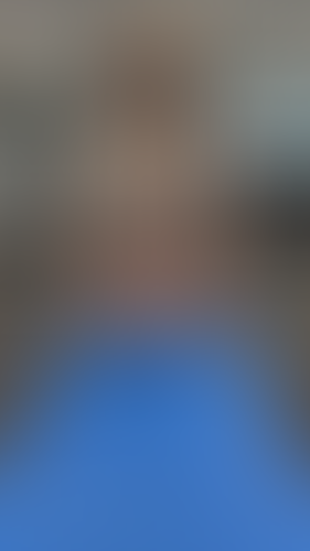 Geblurrte Content-Vorschau