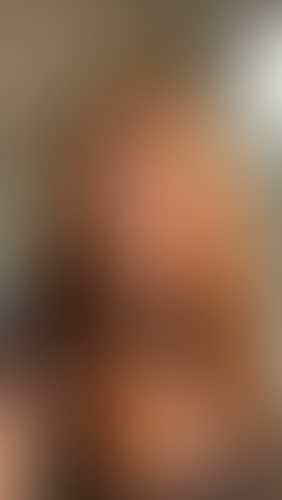 Geblurrte Content-Vorschau