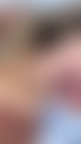 Geblurrte Content-Vorschau