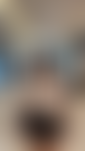 Geblurrte Content-Vorschau