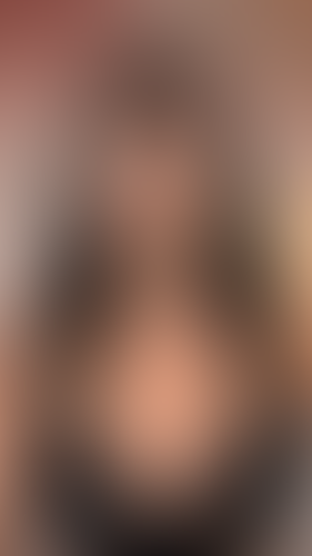 Geblurrte Content-Vorschau