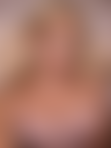 Geblurrte Content-Vorschau