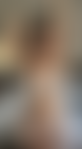 Geblurrte Content-Vorschau