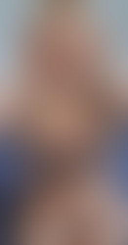 Geblurrte Content-Vorschau