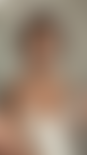 Geblurrte Content-Vorschau