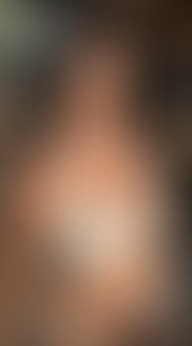 Geblurrte Content-Vorschau