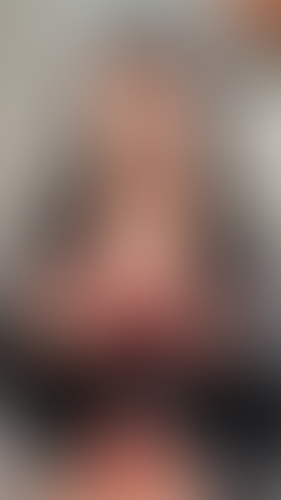 Geblurrte Content-Vorschau