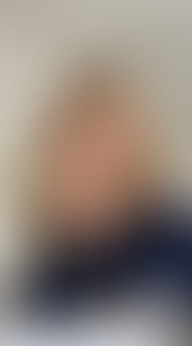Geblurrte Content-Vorschau