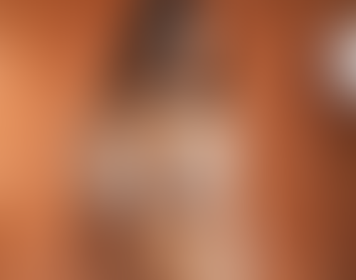 Geblurrte Content-Vorschau