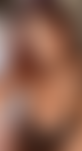 Geblurrte Content-Vorschau
