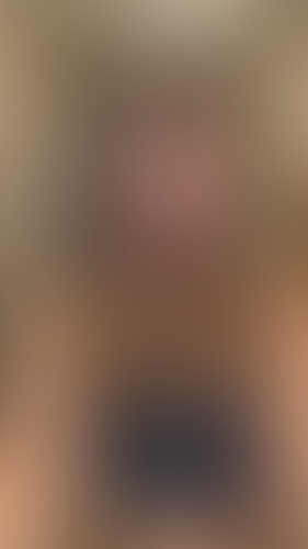 Geblurrte Content-Vorschau