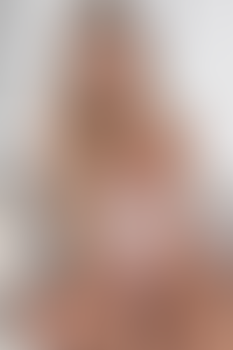 Geblurrte Content-Vorschau