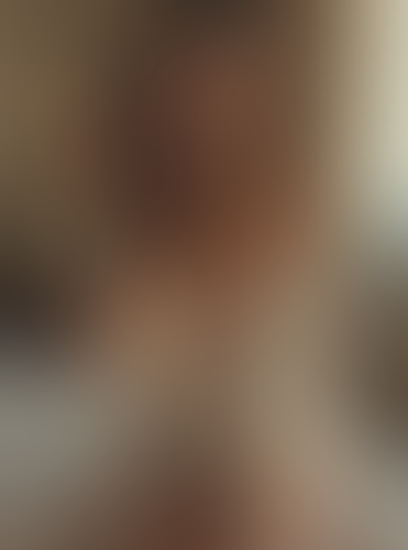 Geblurrte Content-Vorschau