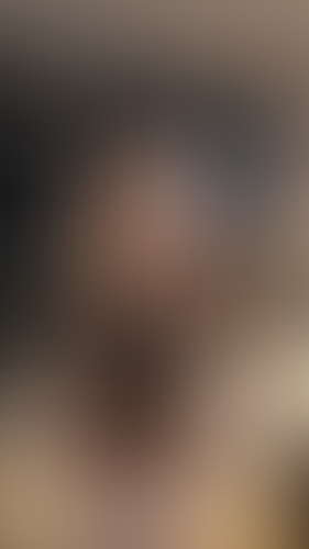 Geblurrte Content-Vorschau