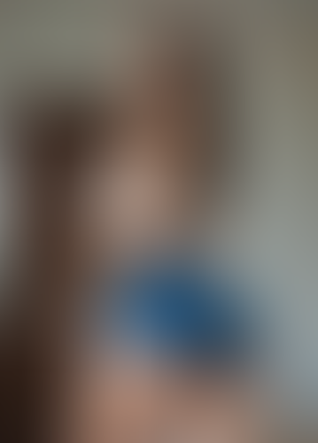 Geblurrte Content-Vorschau
