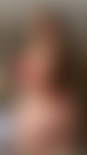 Geblurrte Content-Vorschau