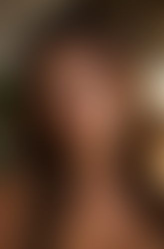 Geblurrte Content-Vorschau