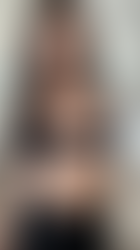 Geblurrte Content-Vorschau