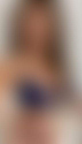 Geblurrte Content-Vorschau