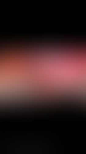 Geblurrte Content-Vorschau
