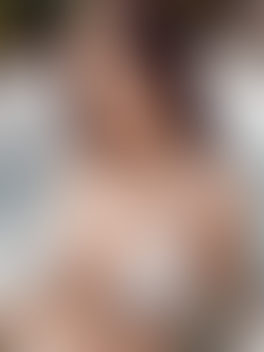 Geblurrte Content-Vorschau