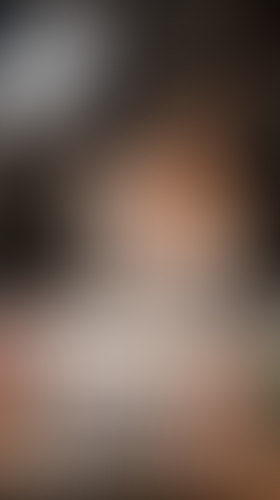 Geblurrte Content-Vorschau