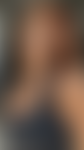 Geblurrte Content-Vorschau