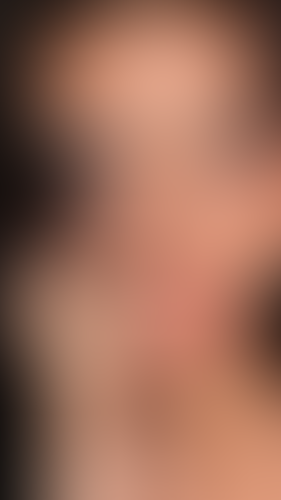 Geblurrte Content-Vorschau