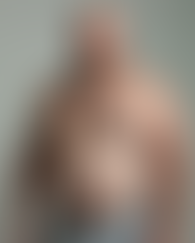 Geblurrte Content-Vorschau