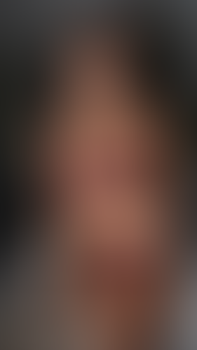 Geblurrte Content-Vorschau