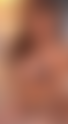 Geblurrte Content-Vorschau