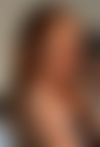 Geblurrte Content-Vorschau
