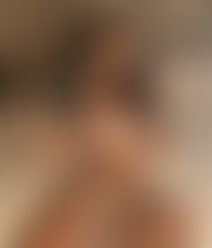 Geblurrte Content-Vorschau