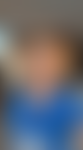 Geblurrte Content-Vorschau