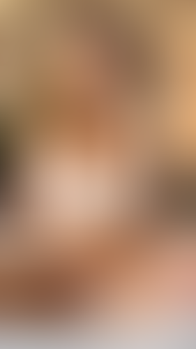 Geblurrte Content-Vorschau