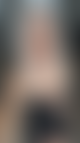 Geblurrte Content-Vorschau