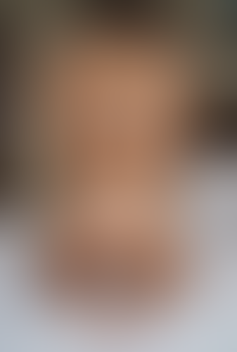 Geblurrte Content-Vorschau