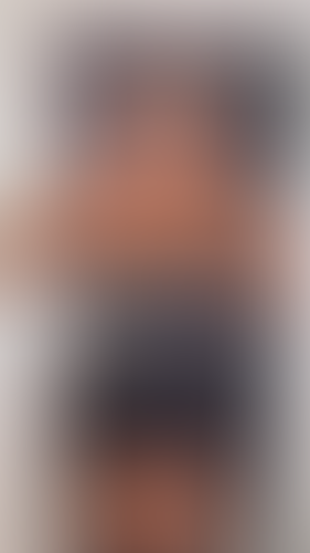 Geblurrte Content-Vorschau