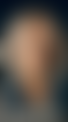Geblurrte Content-Vorschau