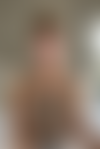 Geblurrte Content-Vorschau
