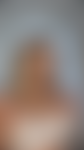 Geblurrte Content-Vorschau
